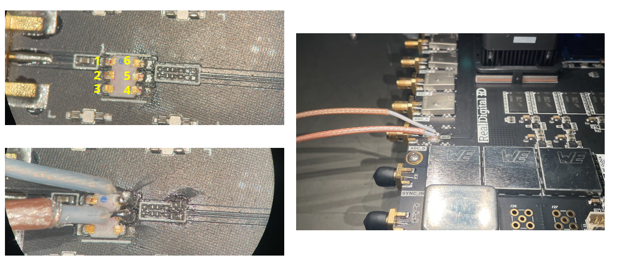 Balun Surgery